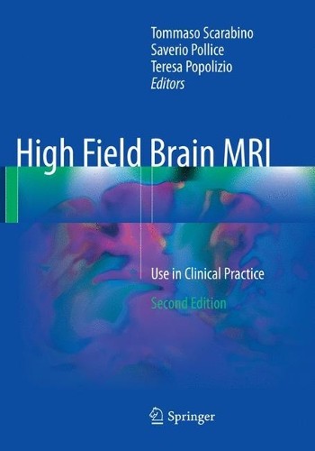 High Field Brain MRI - 9783319830032
