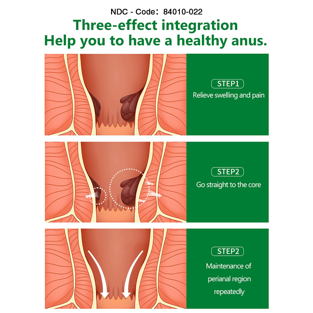 3PCS Hemorrhoids Remove Ointment Herbal Cream Relief Piles Pain Reduce Itching