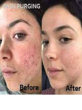 Skin Brightening Cream Extra Strength Lighter FAST Result-NO SIDE EFFECTS 3pack