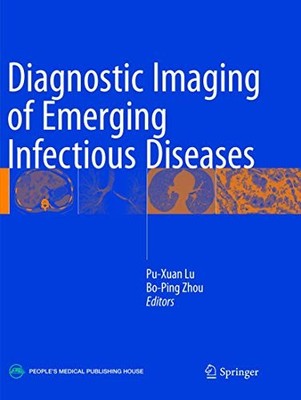 Diagnostic Imaging of Emerging Infectious Diseases, Lu, Zhou 9789402413359..