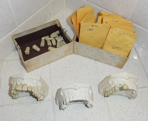 Vintage Dental Model Lot Tooth Impressions removable artificial teeth oddity