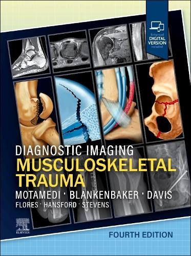 Diagnostic Imaging: Musculoskeletal Trauma by Kambiz Motamedi... - 9780443433429