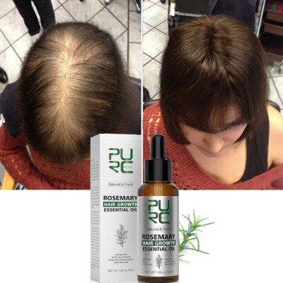 PURC-aceite de ROMERO para Hombre y Mujer, para el CRECIMIENTO del Cabello