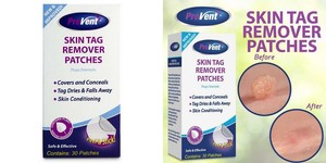 provent skin tag remover patches details