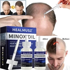 2Pack Minoxidil 5% Extra Strength Men 2 Month Supply Hair Regrowth Solution 50ml