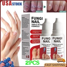 2PCS Fungi-Nail Anti-Fungal Liquid Solution Kills Fungus That Can Lead To Nail