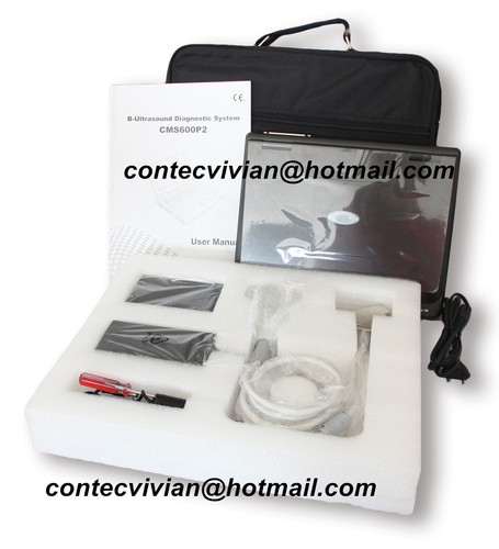 CONTE Digital Ultrasound Scanner Portable Laptop Machine,3.5 Convex Probe, Human - Picture 9 of 12