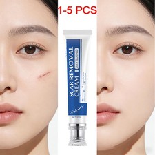 Scar Removal Cream for Stretch Marks, Surgical, Burns Injuries Scars Removal