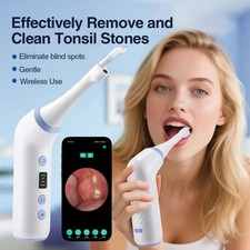 Visible Tonsil Stone Remover Kit with HD Camera, 3 Suction Levels, LED Light
