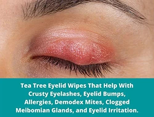 Mediviz Tea Tree Eyelid Wipes Exfoliating,Hypoallergenic Eyelid Scrubs (30-Pack)