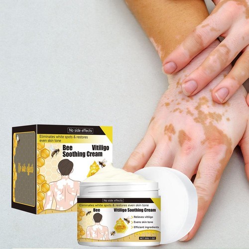 Crema lenitiva vitiligine veleno d'api D3H7 - Foto 3 di 18