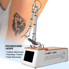 Tattoo Removal with Picosecond Nd YAG Laser Machine for Freckles  Skin Spots