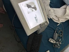 Natus Algo 5 Newborn Hearing Screener with Preamp, Cables, Leads, and Printer