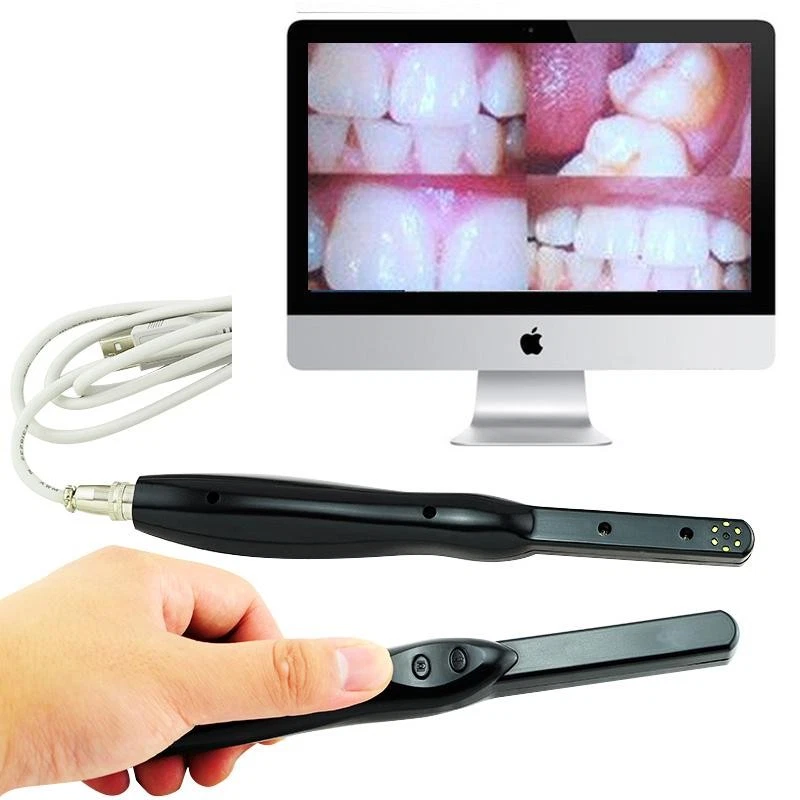 Cámara intraoral dental HD USB 2.0 6 megapíxeles 6 LED imagen clara A+ Foto 2 de 4