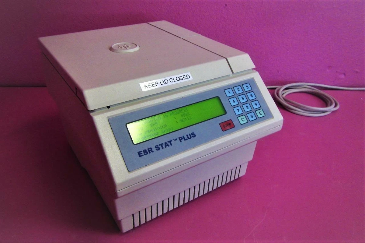 Stat esr