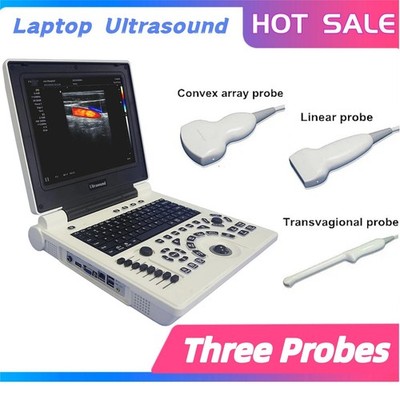 12 ''Laptop ultrasound Color Doppler machine Transvagional ,Linear,Convex probes