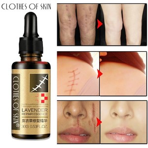 serum to remove acne marks