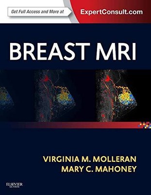 BREAST MRI: EXPERT CONSULT: ONLINE AND PRINT By Molleran Virginia Md & Mahoney