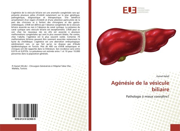 AgéNéSie De La VéSicule Biliaire Kamel Helali-image
