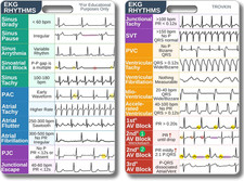 EKG Rhythm Interpretation Badge Card, Nursing Telemetry Medical Cardiac Referenc