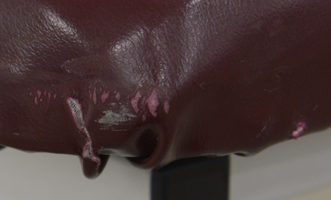 Armedica AM-200 Hi-Lo Two Section Treatment Table W/ Footswitch