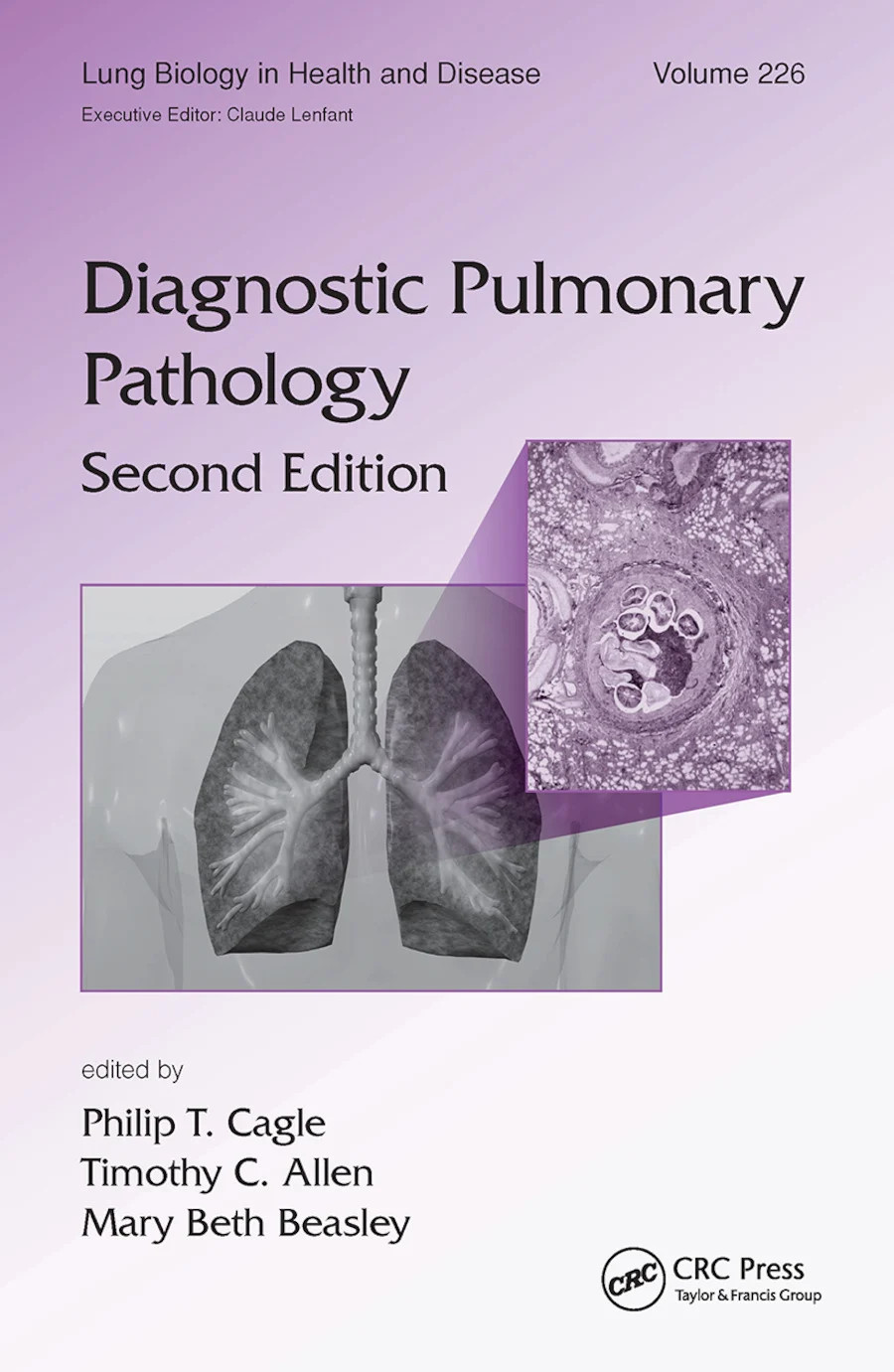 Diagnostic Pulmonary Pathology - 2nd Edition