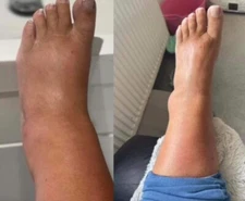 Nu Skin Nuskin Ageloc RenuSpa IO  + Conductive Gel Nuskin Renu Spa