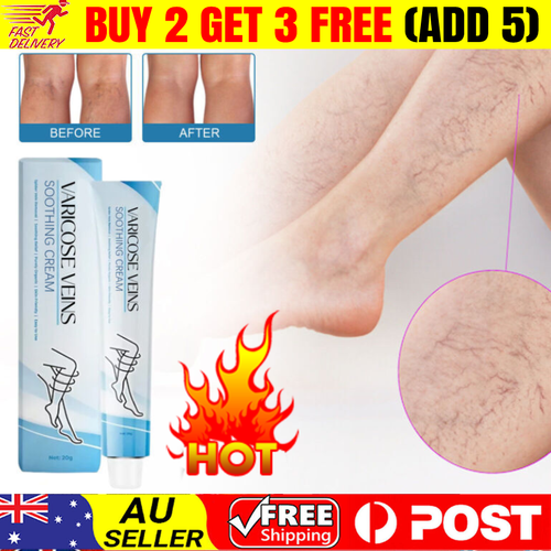 Varicose Veins Cream, Varicose Veins Treatment Cream for Legs 20g Hot