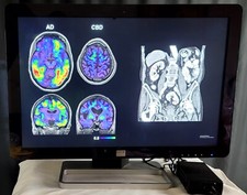 Barco Coronis Fusion MDCC-6230 6MP 30" Color PACS Radiology Monitor TESTED