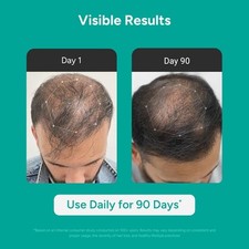 Hair Growth Serum with 3 Redensyl, 3 Procapil, 5 Kopexil, Caffeine 1 fl oz
