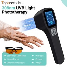 308nm Excimer UVB Light Phototherapy Dual Modes Adjustable Intensity for Adults