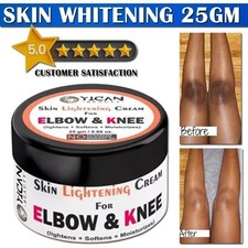 Whitening Cream For Intimate Areas  Dark Knuckle Finger Elbow and Knee 25gm