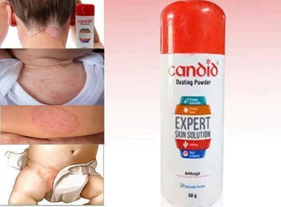 candid powder for baby rashes