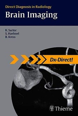 BRAIN IMAGING: DIRECT DIAGNOSIS IN RADIOLOGY (DX-DIRECT By Klaus Sartor & Stefan