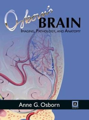 Osborns Brain, 1e - Hardcover By Osborn MD  FACR, Anne G - VERY GOOD