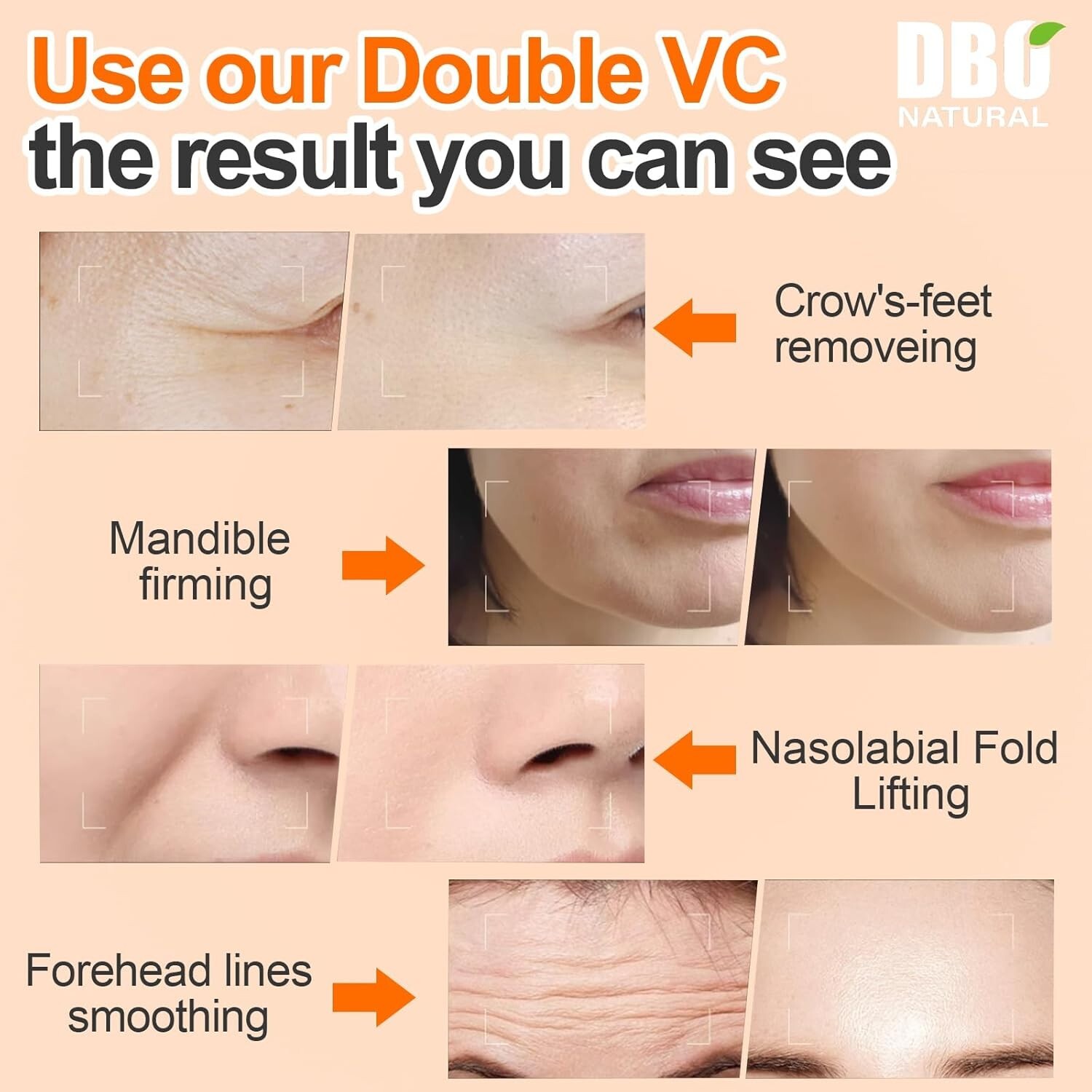 Bright Vitamin C Face Serum for Glowing Skin 30ml