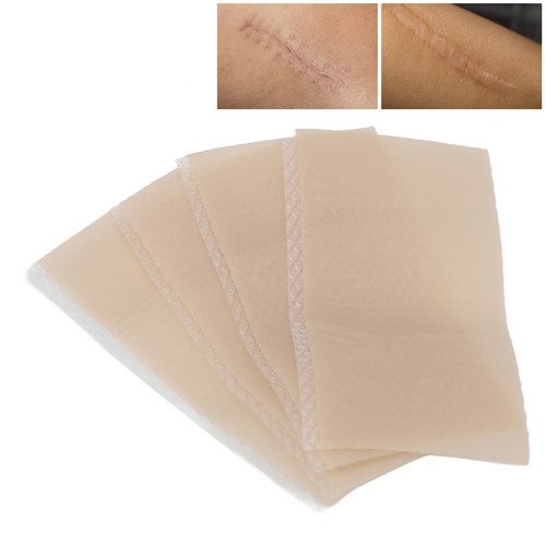 8x Silicone Scar Sheets Soften Flatten Scar Stretch Marks Scar Removal Treatment - Picture 2 of 12