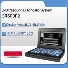 SR600P2 Macchina Scanner Ultrasuoni Digitale Portatile con Sonda CONVESSA