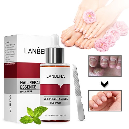 2.LANBENA Nail Repair Essence Remove Onychomycosis Serum Fungal Treatment Toe - Picture 12 of 17