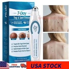 Skin Tag  Mole Eraser Pen Painless, Long-Lasting Spot Removal Tool