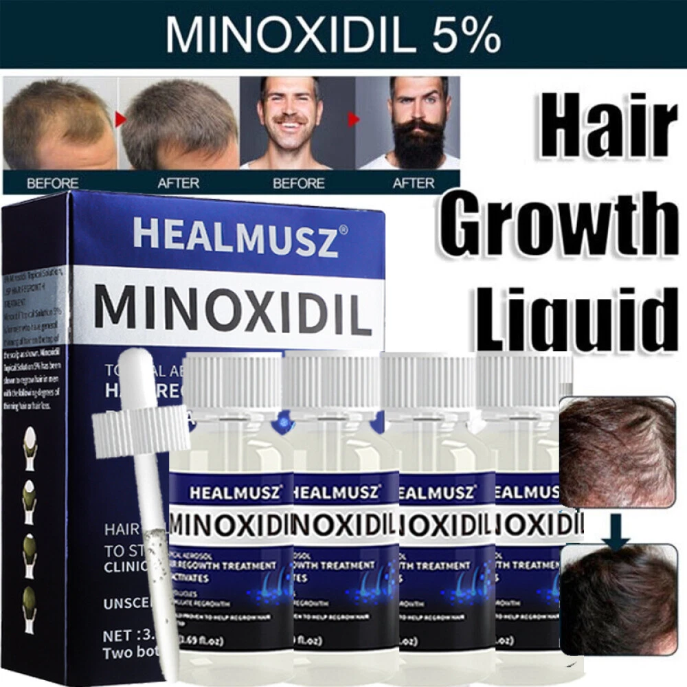New 4 Month Supply Extra Strength MINOXIDIL 5% Hair Growth FOR MEN 6 x 50ML