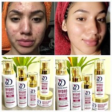 hyaluronic acid skin care products face cream serum moisturizing anti aging set