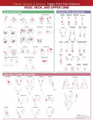 Travell, Simons & Simons Trigger Point Pain Patterns Wall Chart : Head, Neck,...