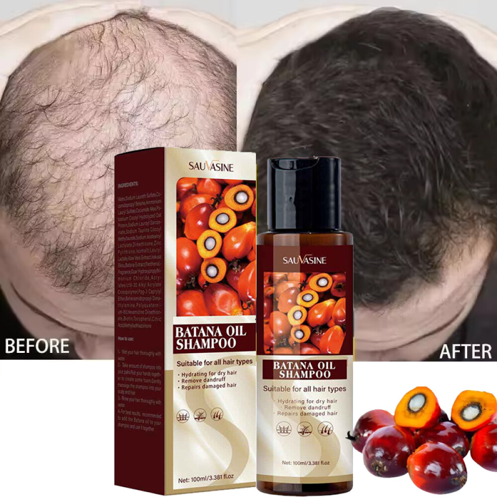 Batana Oil Hair Growth Cream, Natural Botana Oil Shampoo For Hair Loss Treatment