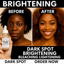 Skin Lightener Cream – Dark Spot Remover Brightening Face & Body Serum