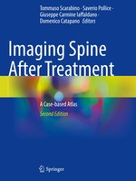 Imaging Spine After Treatment A Case-Based Atlas Tommaso Scarabino (U. A.) Buch