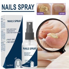 Blinzador Nails Spray Fingernails Nutrition Long-Lasting Toenail Care Supplies