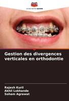Gestion Des Divergences Verticales En Orthodontie Rajesh Kuril (U. A.) Buch 2022