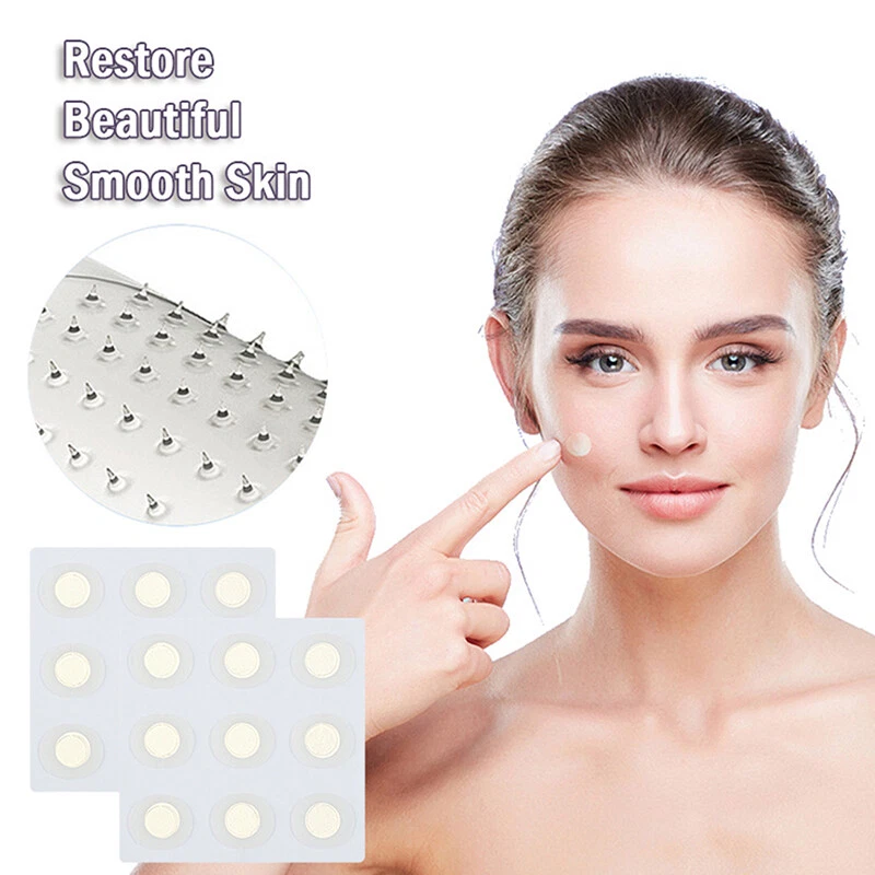 Microneedle on sale acne patch