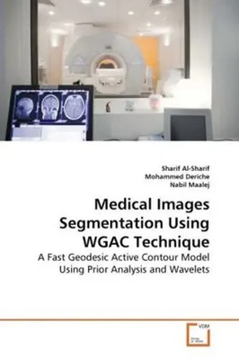 Sharif Al- Sharif (u. a.) | Medical Images Segmentation Using WGAC Technique